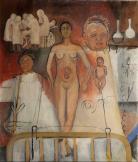 Frida and the Cesarean (unfinished), 1931