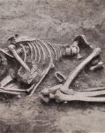 Picture of a Female Skeleton 