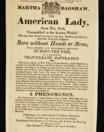 Martha Bagshaw, born without hands or arms, considered a phenomenon.