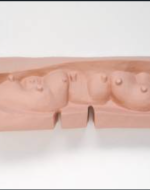 Bourgeois, Louise. Mamelles. 1991. 