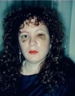 Goldin, Nan. Nan One Month After Being Battered. 1984. 