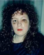 Goldin, Nan. Nan One Month After Being Battered. 1984. 