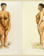 Illustration of Sawtche, named Sarah "Saartjie" Baartman  by C. De Lasteyrie. 1815. Bibliothèque nationale de France