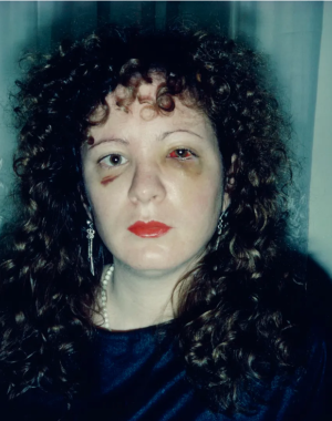 Frida Kahlo's 1940 Self Portrait With Cropped Hair, Nan Goldin's 1984 Battered