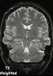 Examples of MRI scans