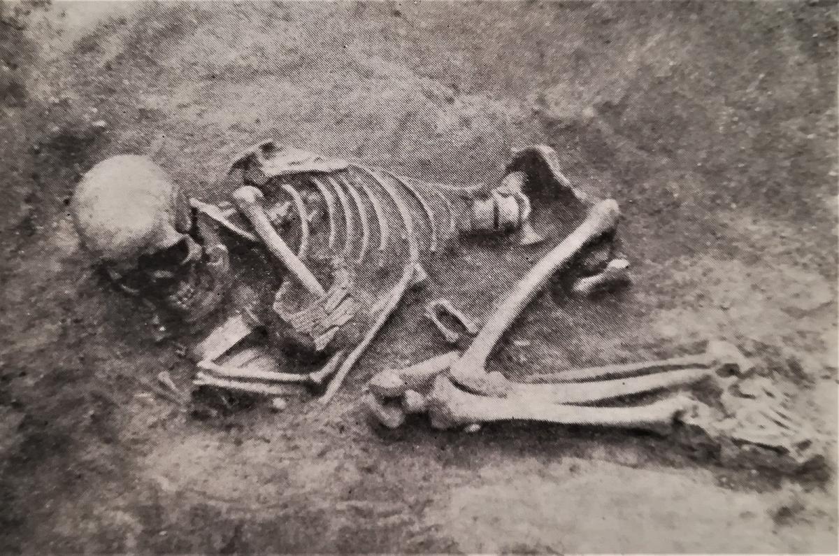 Picture of a Female Skeleton 